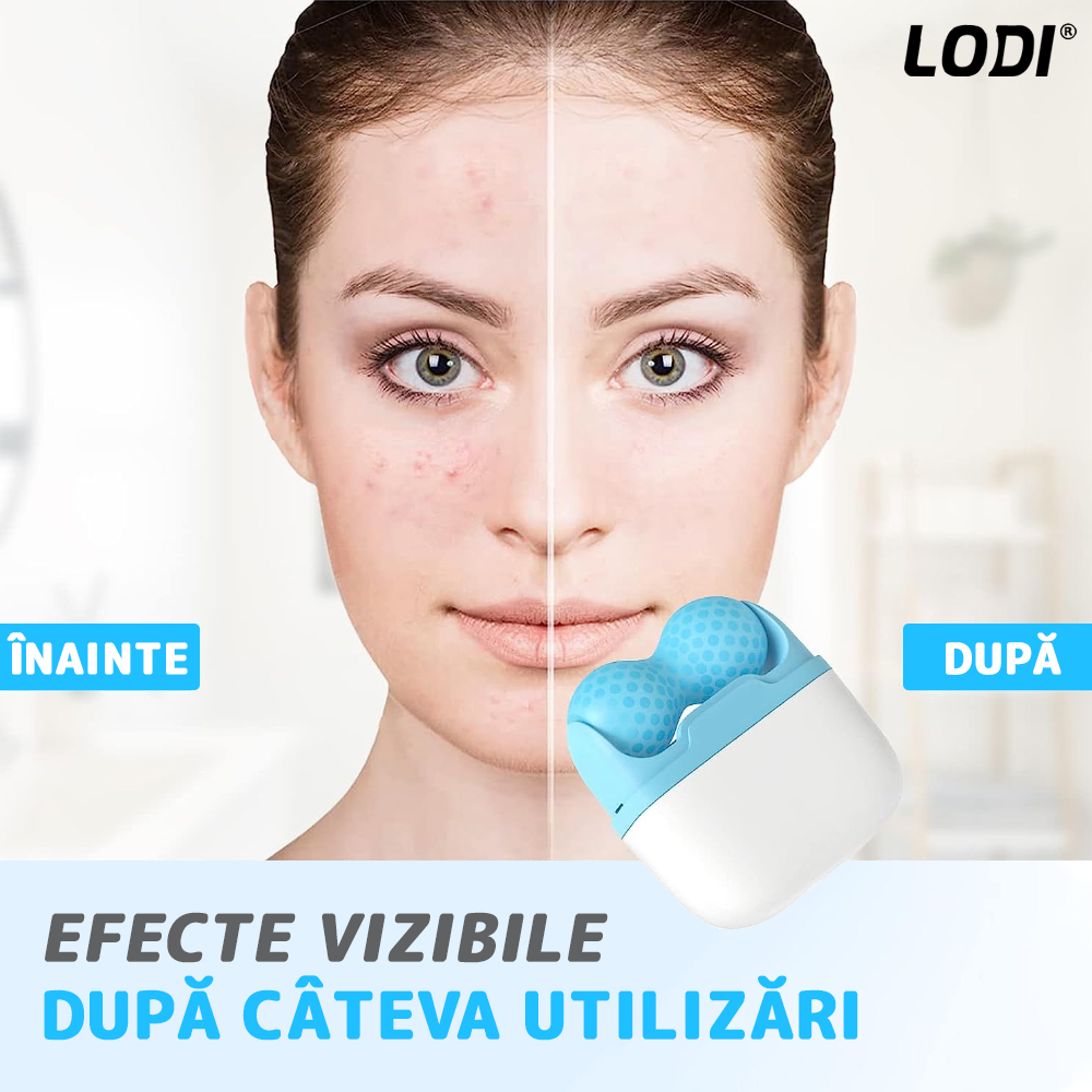 Rola de Masaj cu Gheata Lodi50, Ice Roller, 2 capete W si V, anti-aging, ingrijirea tenului, tonifiere, albastru/alb