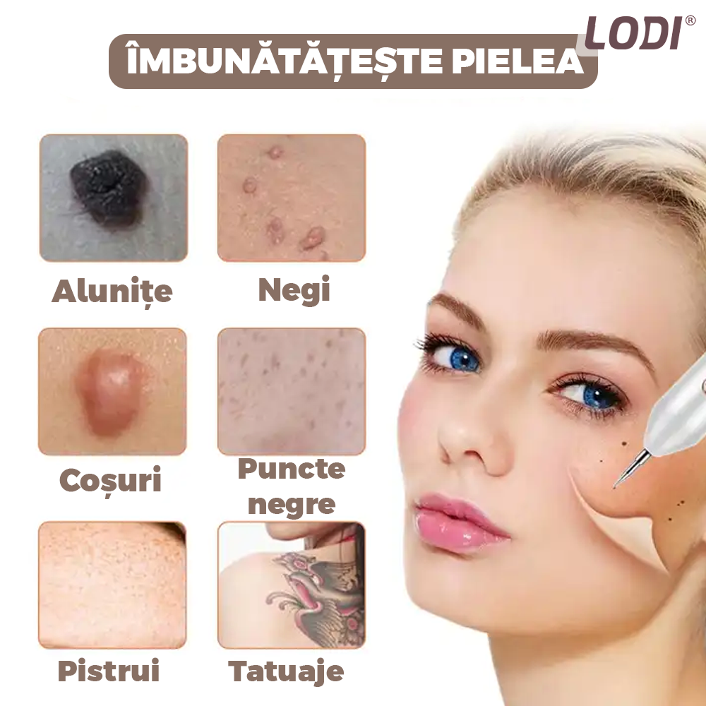 Aparat Plasma Pen Lodi524, 9 viteze, 5 ace de schimb incluse, indepartarea alunite, pete, negi, cicatrici, tatuaje, pistrui, lifting pleoape, afisaj LCD, auriu