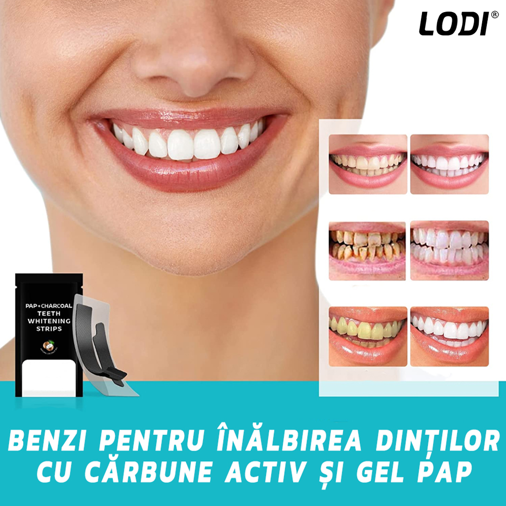 Set 14 Benzi pentru Albirea Dintilor Lodi471, IVISMILE, Carbune Activ si PAP, 7 Plicuri
