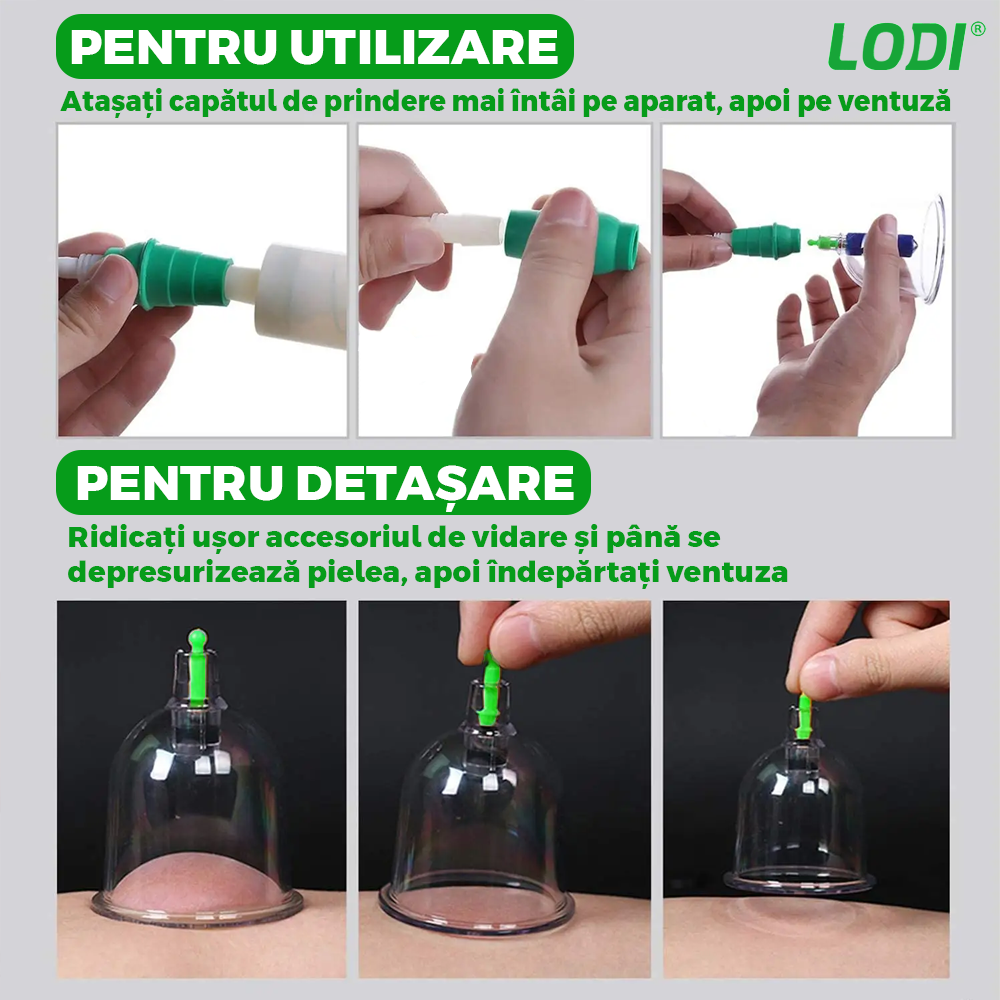 Set 12 Ventuze pentru Masaj Lodi682, beneficii multiple, pompa cu vacuum, terapie, decongestionare, verde