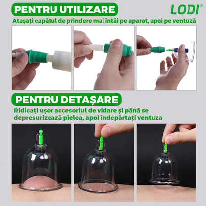 Set 12 Ventuze pentru Masaj Lodi682, beneficii multiple, pompa cu vacuum, terapie, decongestionare, verde