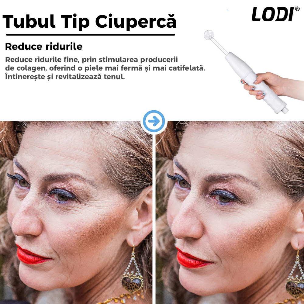 Electroderm Multifunctional Lodi216, tratament cu frecventa inalta pentru acnee, riduri, ten, par, stimulator scalp, infrumusetare faciala, lifting, alb