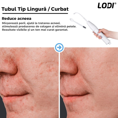 Electroderm Multifunctional Lodi216, tratament cu frecventa inalta pentru acnee, riduri, ten, par, stimulator scalp, infrumusetare faciala, lifting, alb